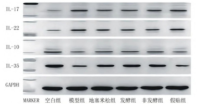 空白組和支氣管哮喘各組大鼠肺組織中IL－17、IL－22、IL－10、IL－35蛋白表達(dá)電泳圖